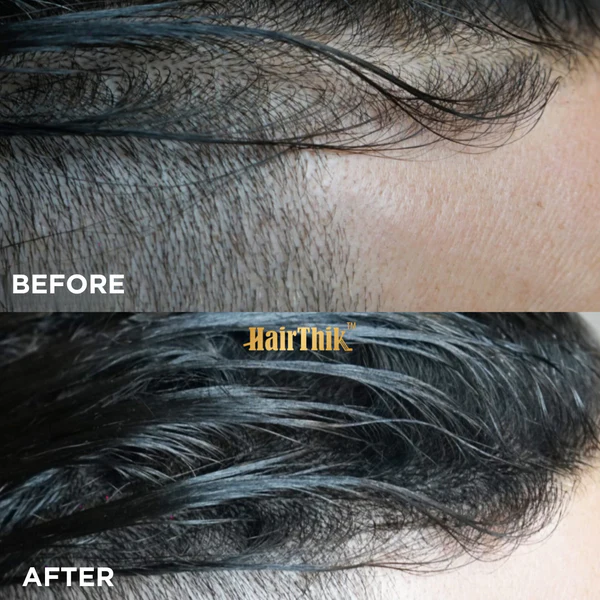 Supreme HairThik Hair Fibres Kit | Black